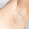 Tips for Underarm Sweating Solutions