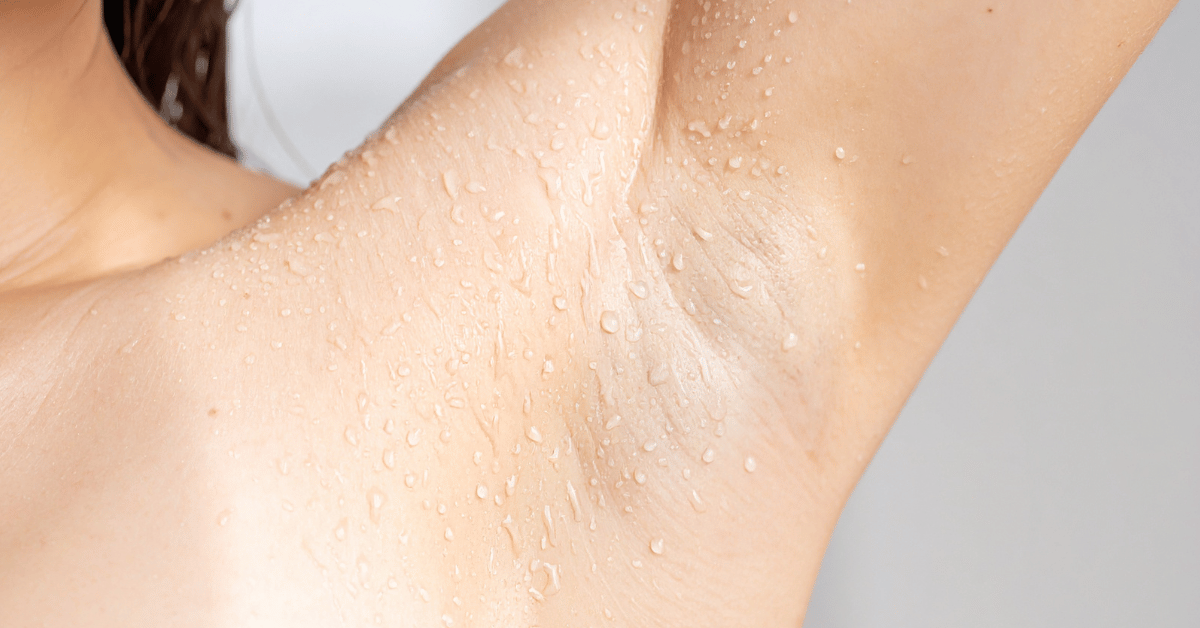 Tips for Underarm Sweating Solutions